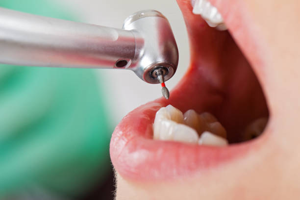 Best Emergency Cosmetic Dentistry in Goldsboro, NC